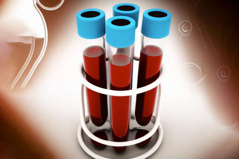 blood in test tubes